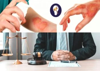 The Common Ways a Burn Injury Can Occur Due to Property Owner Negligence